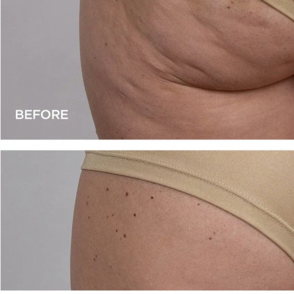 BeautyBio GloPRO® Microneedling Regeneration Head-to-Toe Glo Set - Picture 4 of 10